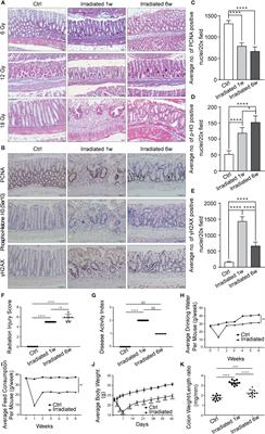 Alterations of the Gut Microbiome Composition and Lipid Metabolic Profile in <mark class="highlighted">Radiation Enteritis</mark>